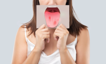 Is jouw tong gezond?