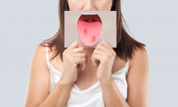 maladie de la langue